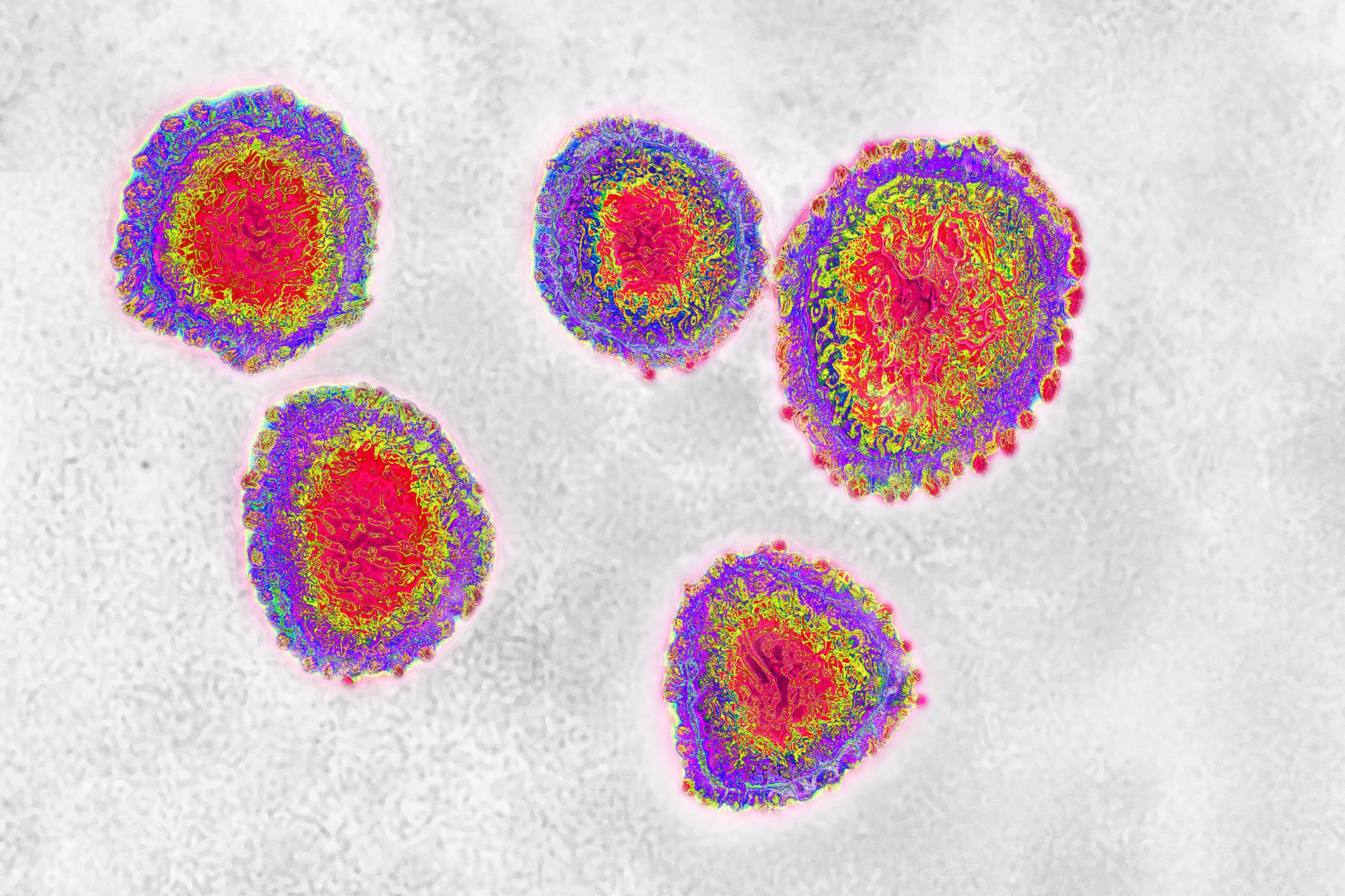 Coronavirus under microscope.